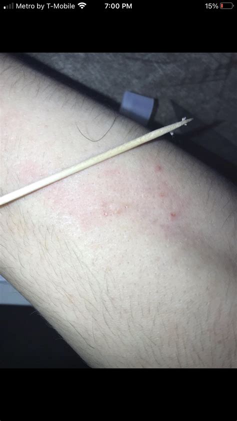 Please help I have extreme anxiety and paranoia, I’ve never seen a bat but can’t get it out of ...