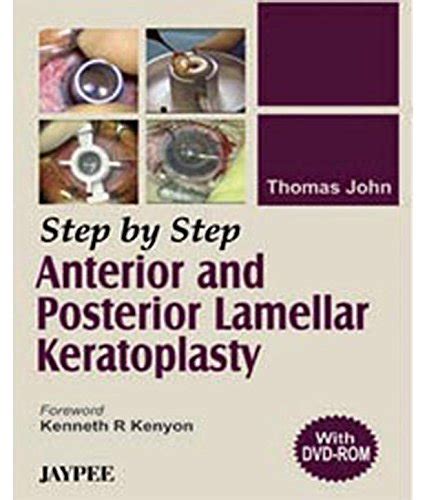 Step By Step Anterior And Posterior Lamellar Keratoplasty(With Dvd ...