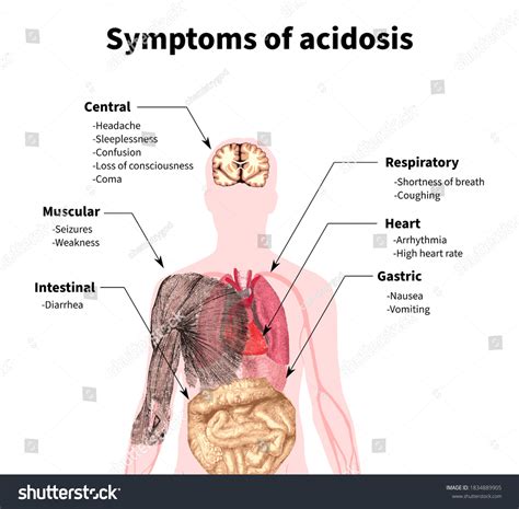 Acidosis Symptoms Acidity Blood Body Tissues Stock Illustration 1834889905 | Shutterstock