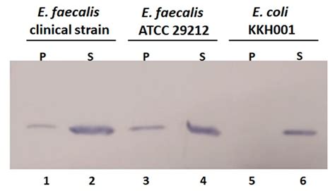 Construction and Activity Testing of a Modular Fusion Peptide against ...