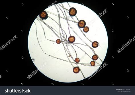 Rhizopus Under Compound Microscope