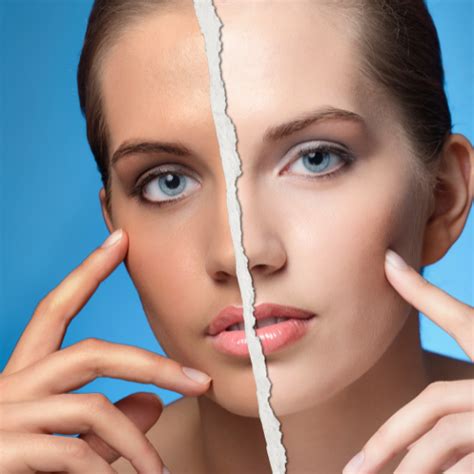 Tan Removal Treatment in Ramamurthy Nagar | Bangalore
