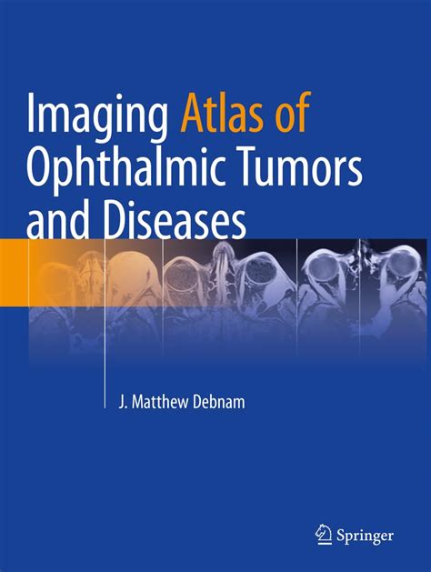 Buy Imaging Atlas of Ophthalmic Tumors and Diseases Book Online at Low ...
