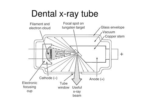 Parts Of X Ray Tube at Philip Ayala blog