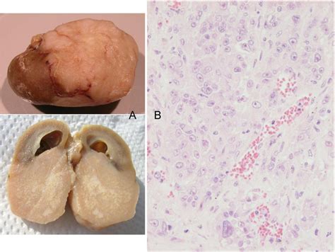 Oncological Outcomes in Rats Given Nephrocarcinogenic Exposure to ...