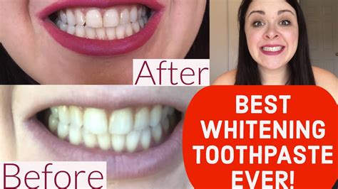 Image result for Best Toothpaste for White Teeth