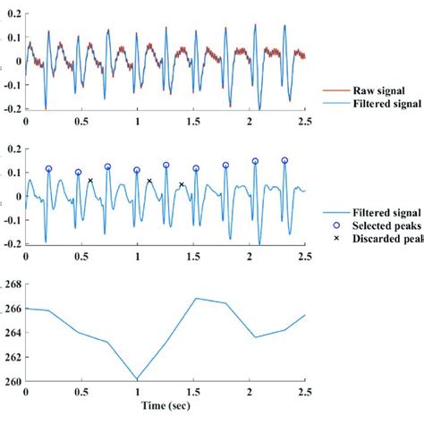 Image result for Beat Detection Algorithm