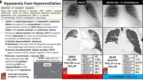 Image result for Pulse Pressure Variation EMCrit
