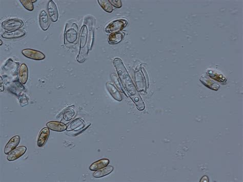 PUBLICATION: The ecology of diatom reproduction | News - Diatoms of North America