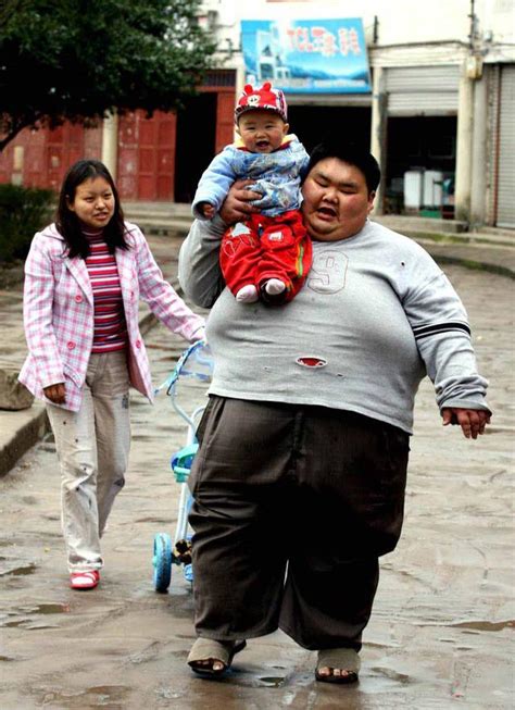 “中国第一胖”梁用，身高155、体重450，今减重200斤，妻子漂亮