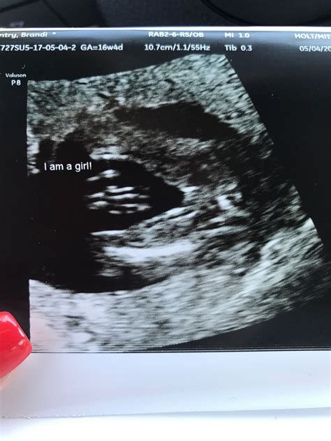 Pin by Brianna Davis on swag outfit | 16 weeks pregnant ultrasound, Ivf ...