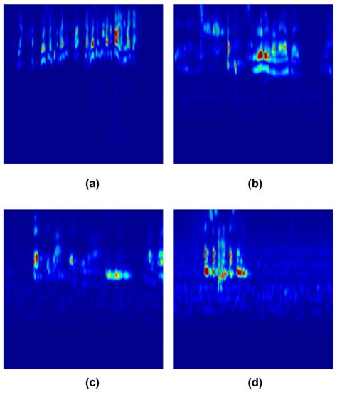 Speech Emotion Recognition Using Transfer Learning: Integration of ...