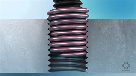 Fitting Helicoils 的图像结果