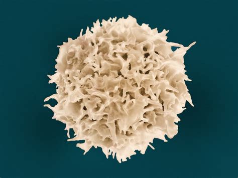 Renal Cell Carcinoma (RCC): Understanding Treatment and Cure ...