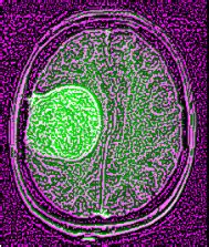 Image result for Extract Data From UI