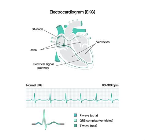 ECG vs EKG: Difference between Electrocardiogram (EKG & ECG)