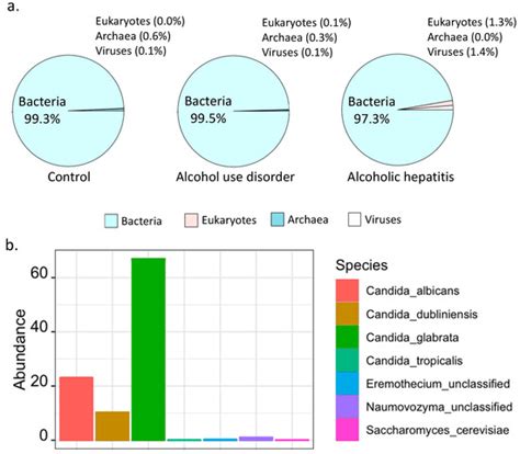 Fungi–Bacteria Correlation in Alcoholic Hepatitis Patients
