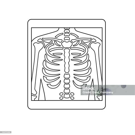 X Ray Drawing For Kids