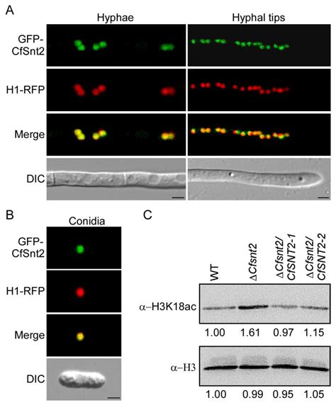 The CfSnt2-Dependent Deacetylation of Histone H3 Mediates Autophagy and ...