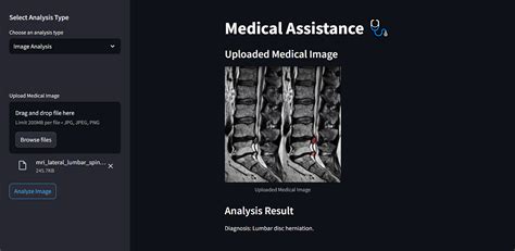 Image result for Streamlit Deep Learning App