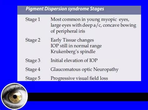 Pigment dispersion syndrome | PPTX