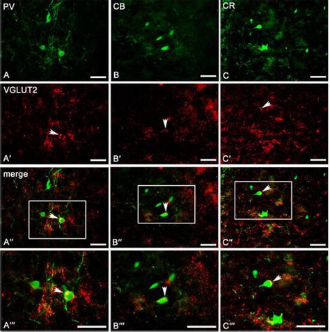The Co-Expression Pattern of Calcium-Binding Proteins with γ ...