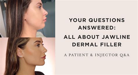 Your Questions Answered: All About Jawline Dermal Filler - Skin by Lovely