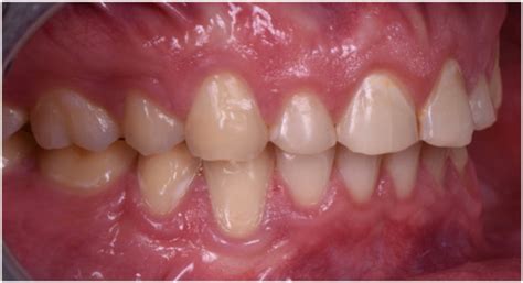 Dentistry Journal | April 2022 - Browse Articles