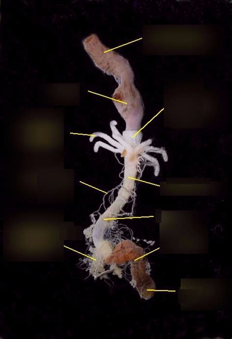 Image result for Digestive System of Cockroach