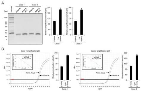 Amplification Failure of the Amelogenin X Gene Caused by a Rare ...