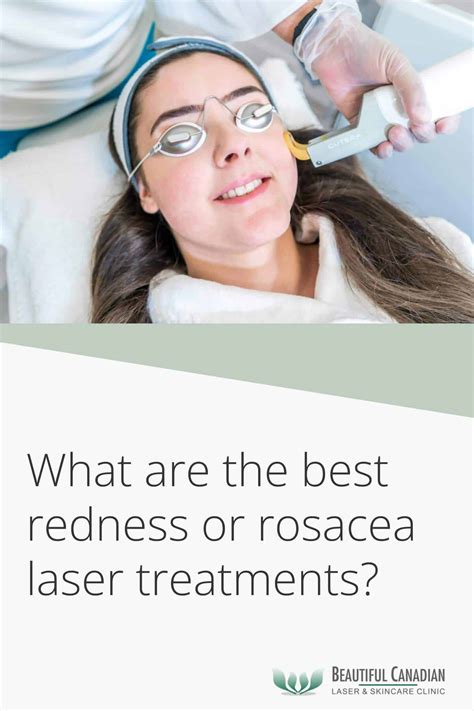 What are the Best Redness or Rosacea Laser Treatments in Vancouver?