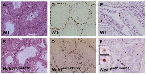 Genes | Special Issue : Genetics of Mammalian Meiosis