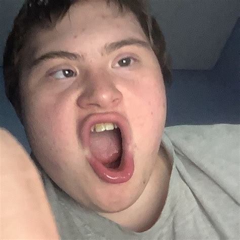 Image result for Scattered Skull YT CWC