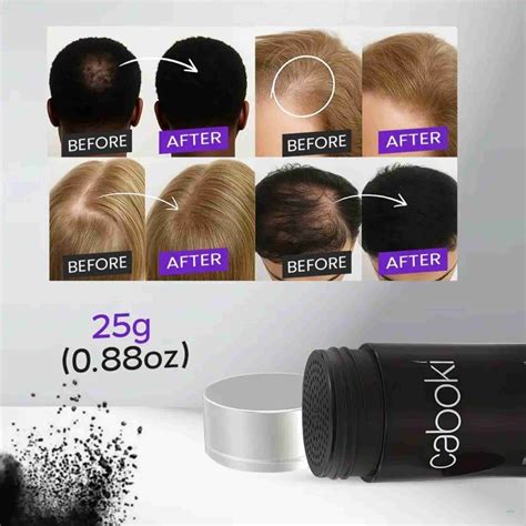 Oilanic Hair Fiber Black - For Realistic Bald Spot Concealment Natural ...