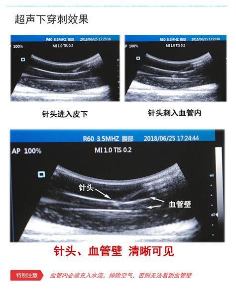 Ultrasound guided vascular puncture model puncture | Ubuy India