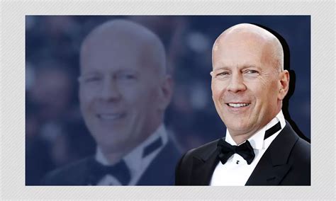 What Is Aphasia, Brain And Speech Disorder Actor Bruce Willis Is ...