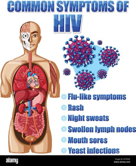 Informative poster of common symptoms of HIV illustration Stock Vector Image & Art - Alamy