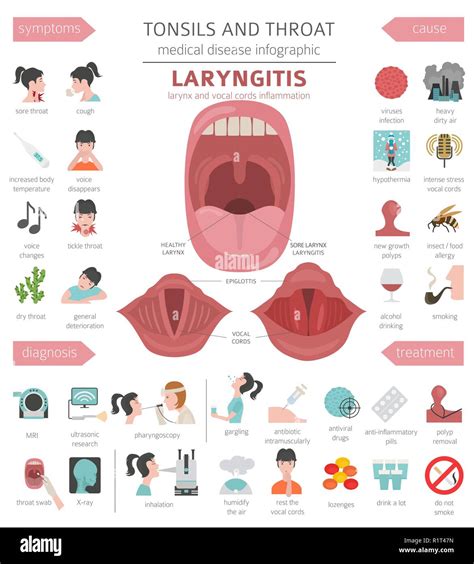 Tonsils and throat diseases. Laryngitis symptoms, treatment icon set. Medical infographic design ...