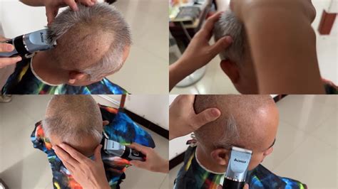 老人花10元剃头后满头伤口最新素材