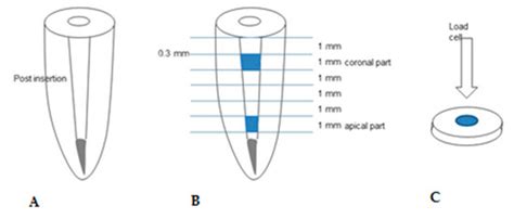 Push-Out Bond Strength Evaluation of Fiber-Reinforced Composite Resin ...