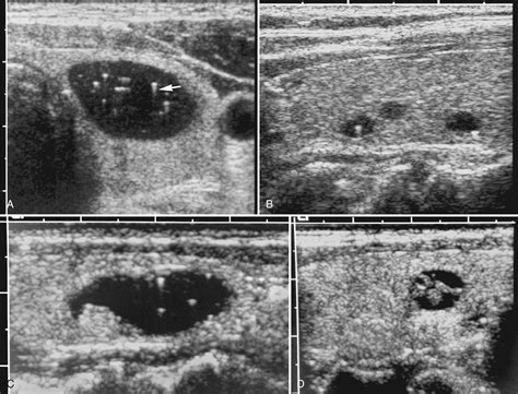 The Thyroid Gland - Clinical Tree