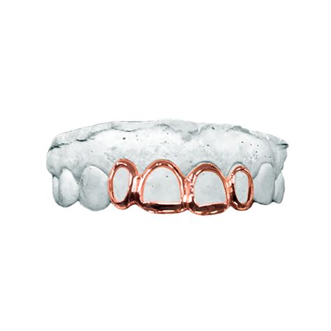 14K Rose Gold Open Grillz – CNJ Gold Teeth
