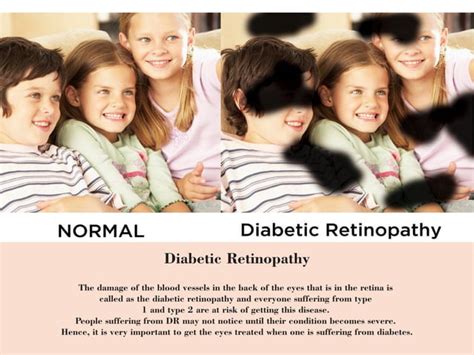 Image result for Types of Vision Problems