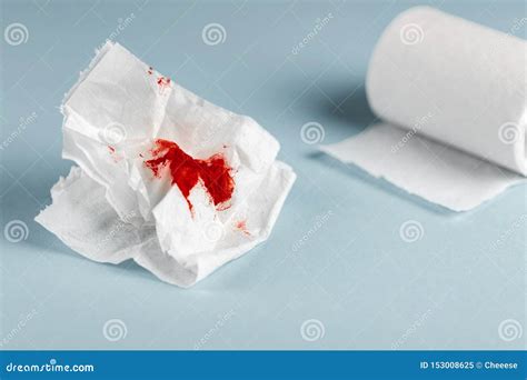 Hemorrhoids Bleeding In Toilet