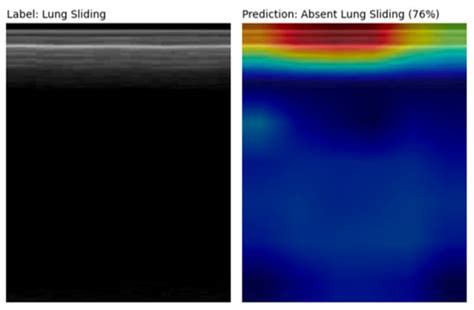 Improving the Generalizability and Performance of an Ultrasound Deep ...