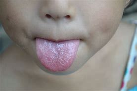 舌头 的图像结果