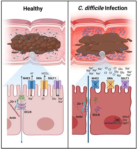 Toxin-mediated downregulation of absorptive ion transporters NHE3, DRA ...