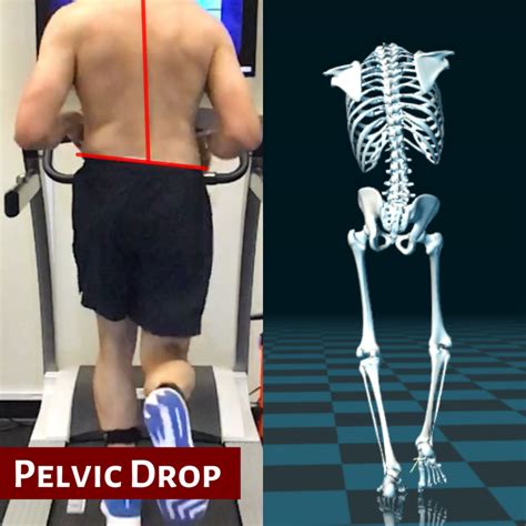 Lower Back Pain From Running (Causes+ How to Fix It) – Marathoners