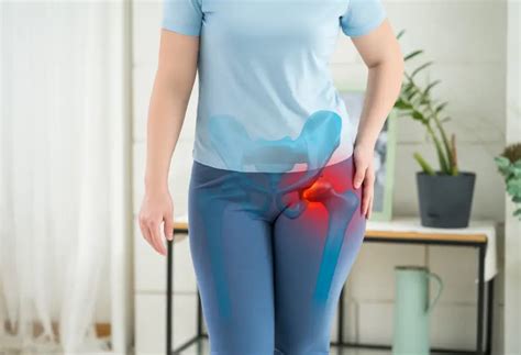 Hip Problem Pain 的图像结果