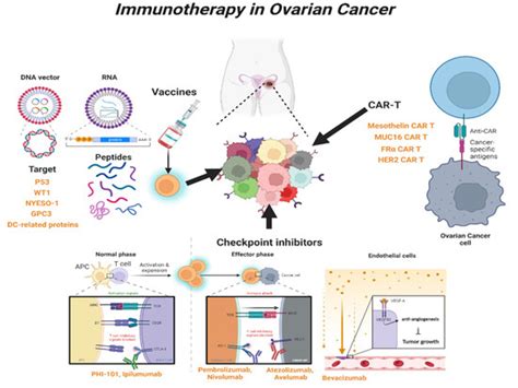 Immunotherapy in Ovarian Cancer | Encyclopedia MDPI